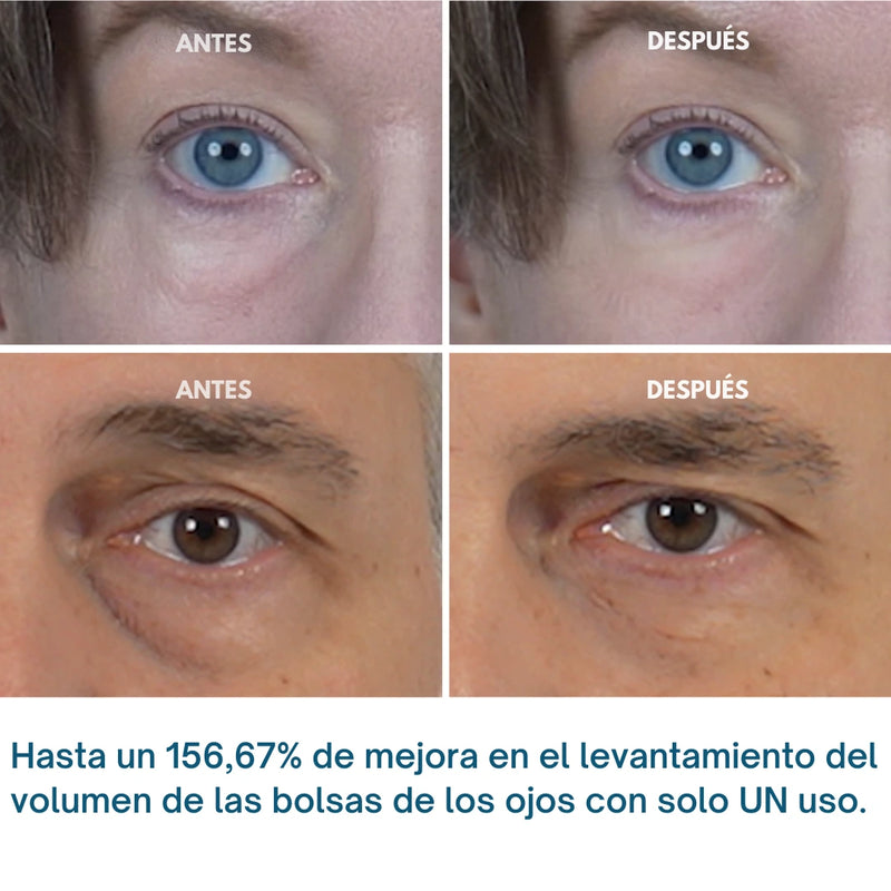 Tratamiento para Ojeras y Bolsas Paga 1 LLeva 2